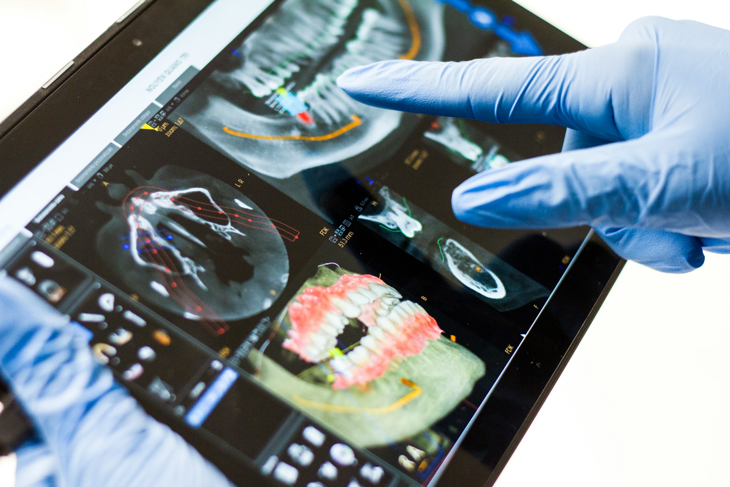 CBCT planning