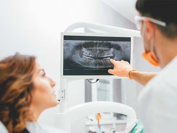 X-ray, panoramic & tomography